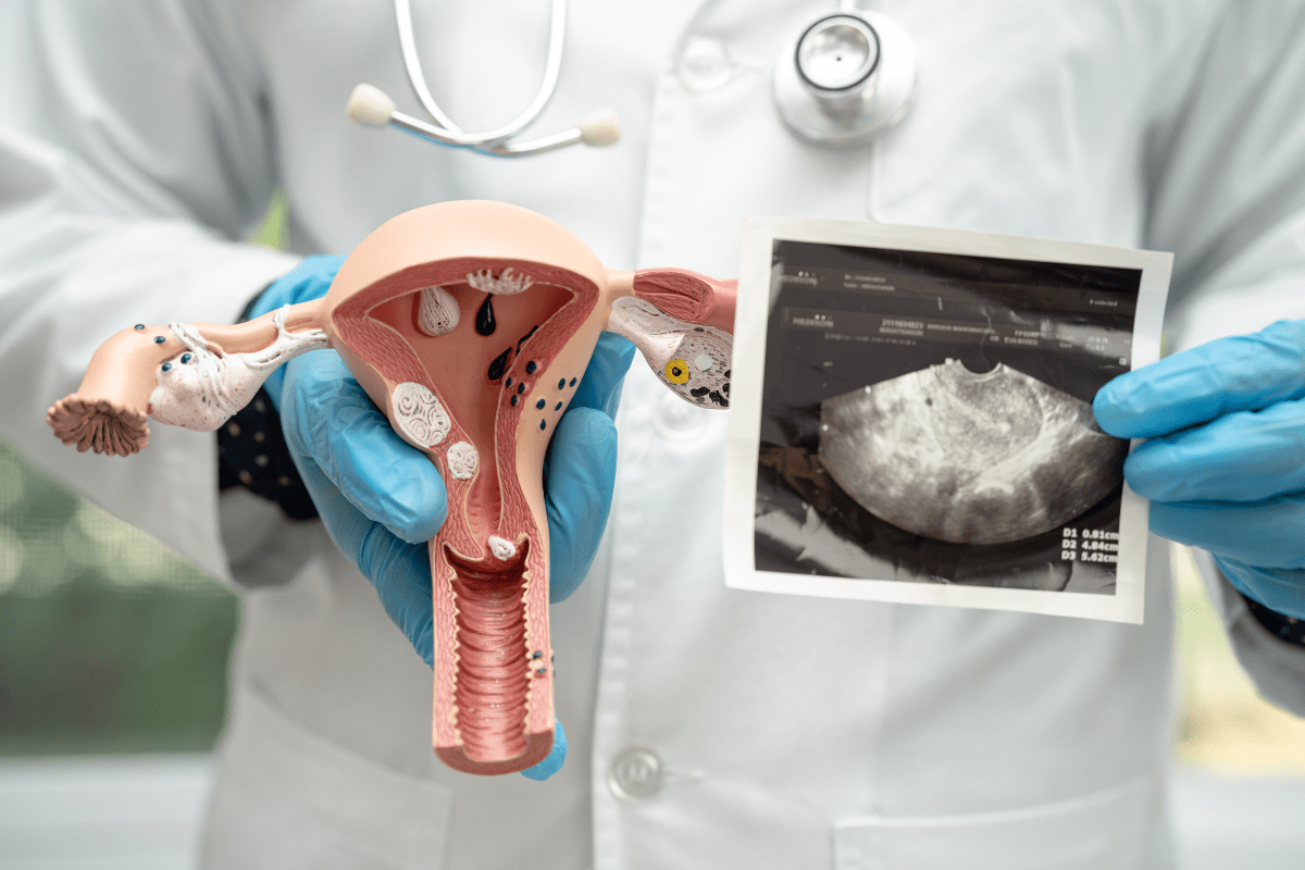 infertility (ivf & in vitro fertilization)-image