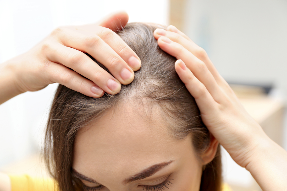 Female Hair Transplant