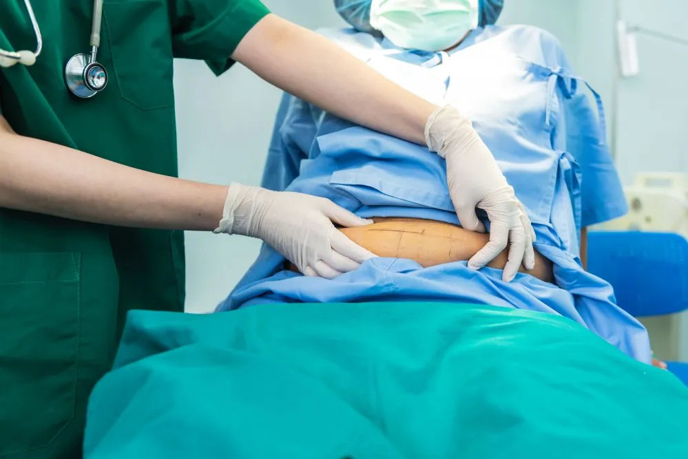 Adipositaschirurgie (Bariatrische Chirurgie)