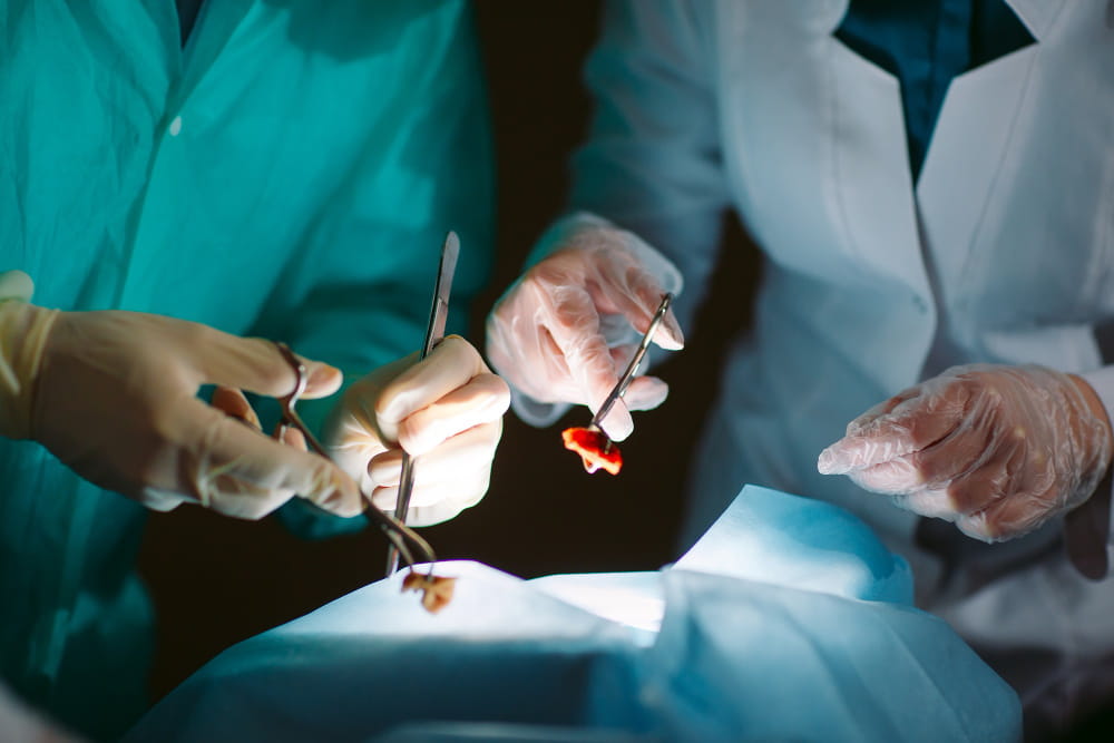 Organ transplantatsiyasi