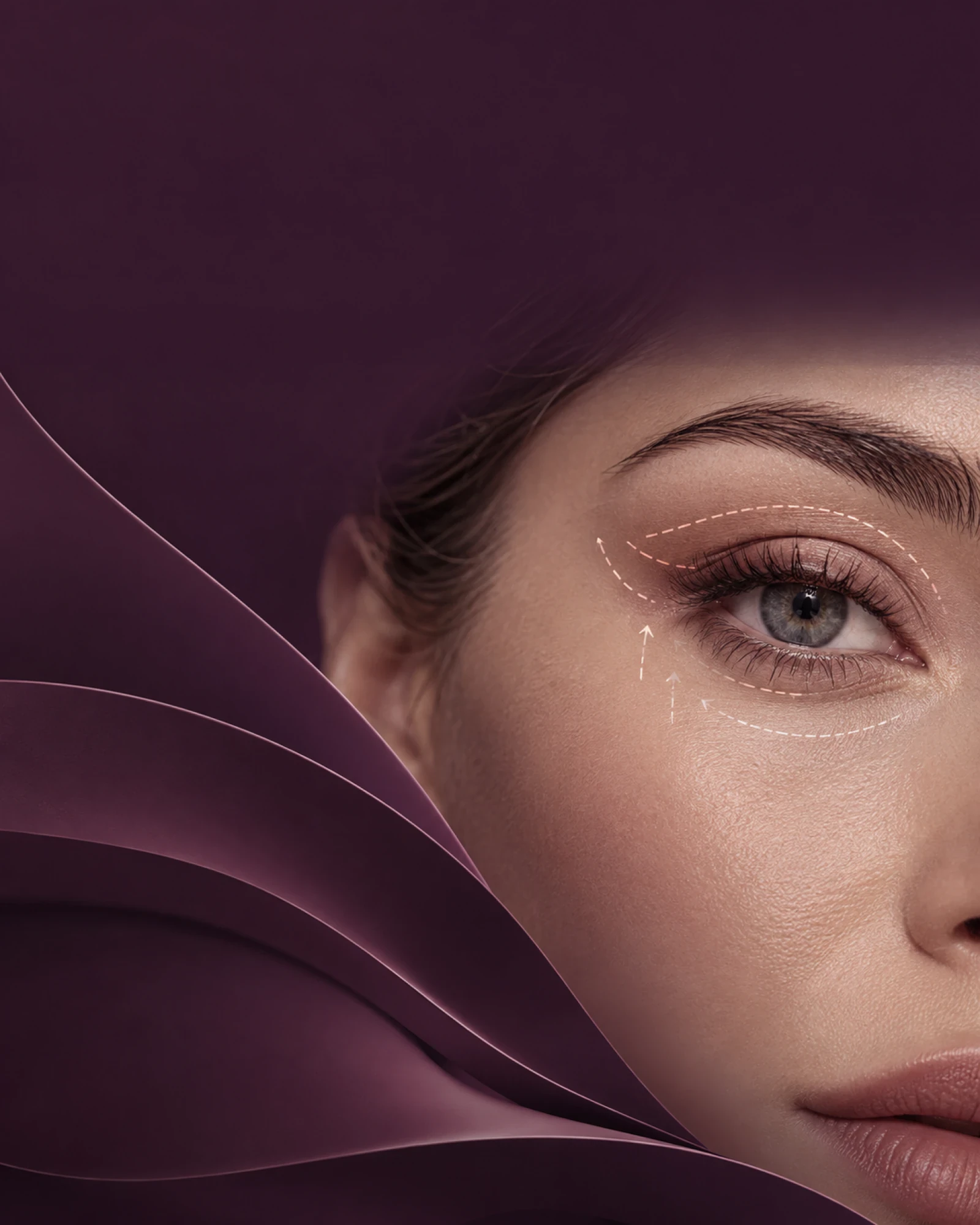 Blepharoplasty in Türkiye: Upper and Lower Eyelid Surgery, Recovery and Return to Europe Guide
